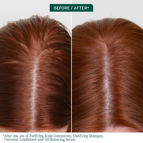 Biolage Scalp Sync Hair Serum - Oil Balancing Leave-In Treatment with Fermented Tea Blend, 1.6 Fl Oz