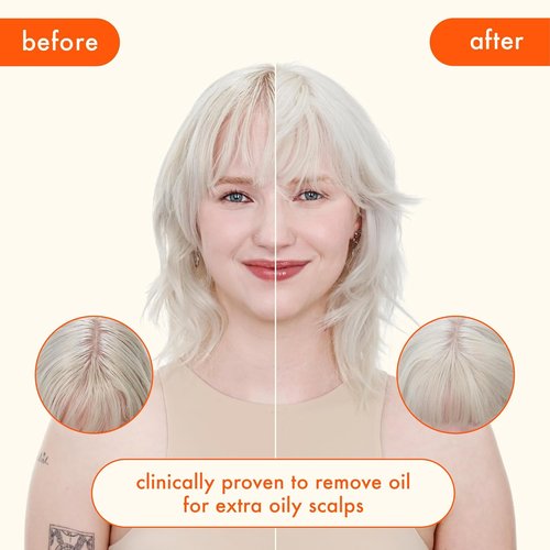amika perk up ultra oil control dry shampoo | cleans + refreshes scalp + roots, absorbs + helps control oils, extends styles between washes, for all hair types with extra oily scalps