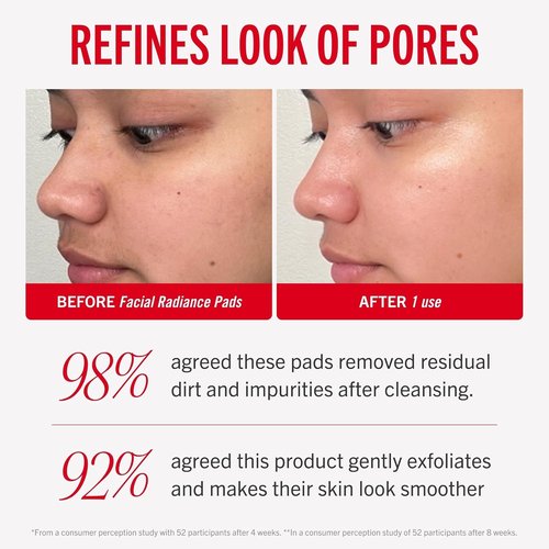First Aid Beauty - Daily Exfoliating Facial Radiance Pads with AHA | Visibly Smaller Pores, 60 Count