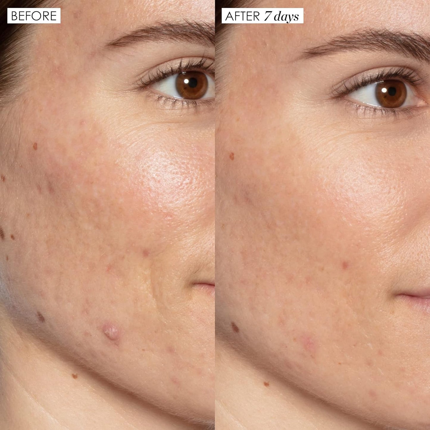 Sunday Riley Good Genes Lactic Acid Treatment - All-in-One Face Serum for Radiant Skin