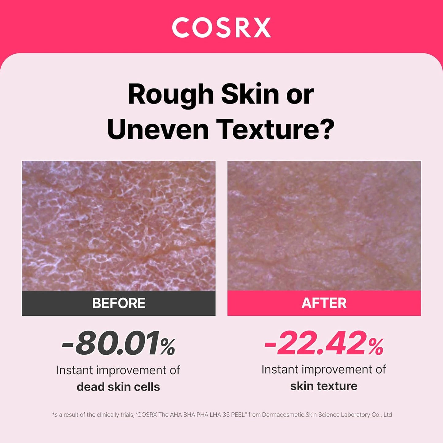 COSRX AHA BHA PHA LHA 35% Peel - Chemical Exfoliating Gel for Dull, Oily Skin | 1.01 fl. oz / 30 ml