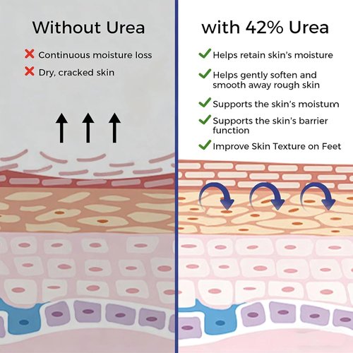 OUKEYA Urea Cream 42% - Moisturizing Foot Cream with 2% Salicylic Acid for Dry Skin | 5.29 Oz
