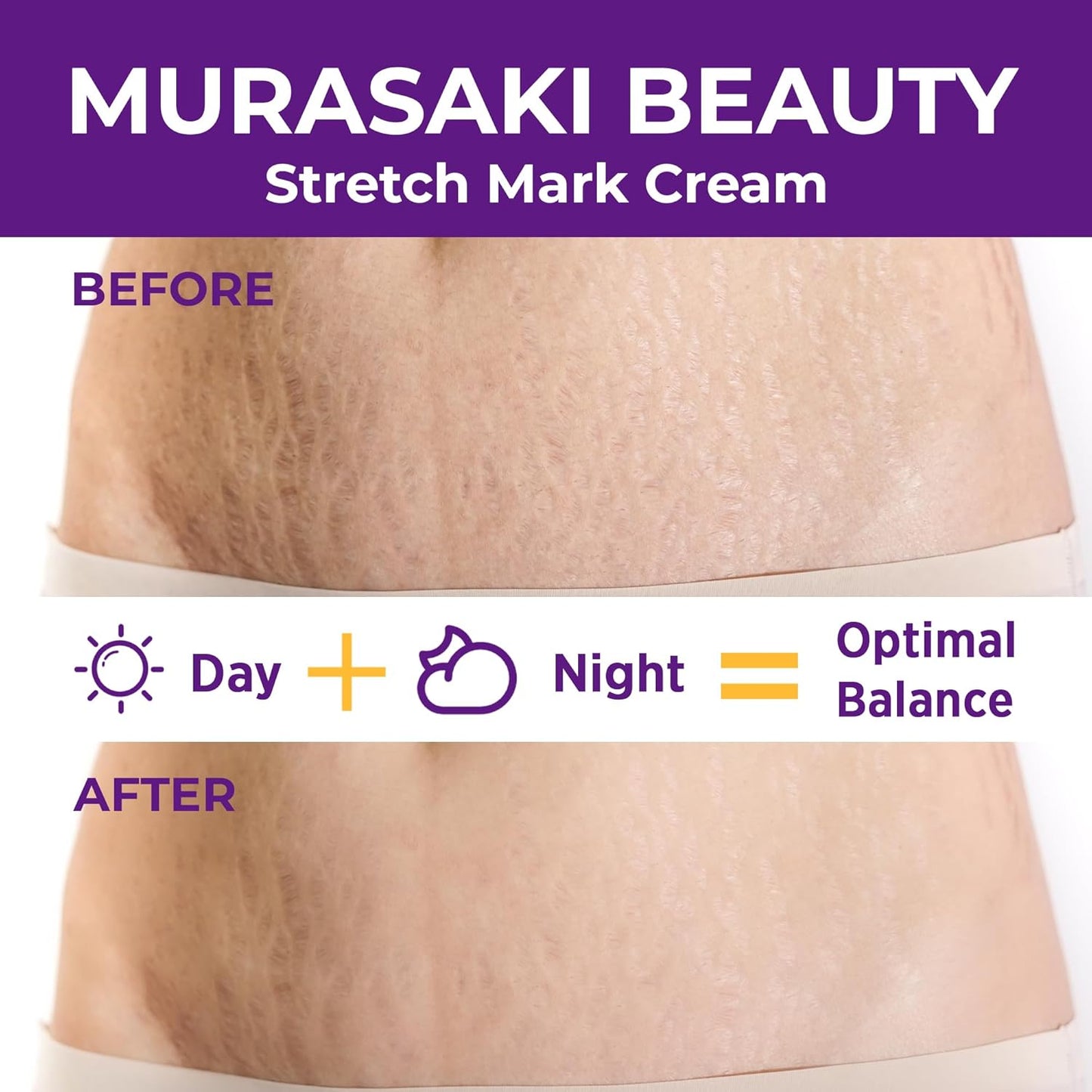 Skiennix Stretch Mark Cream - Nourishing Maternity Formula for Prevention & Elasticity | 4 oz (120g) - 2 Pack