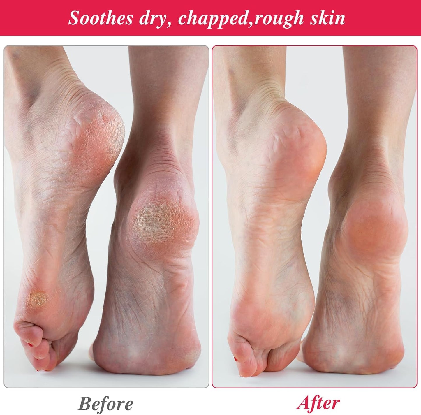 Skiennix Reusable Cotton Spa Socks - Hydrating Foot Mask Sleeves for Dry, Cracked Feet | 10-Pack
