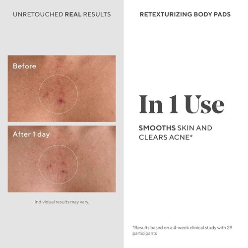 Murad Retexturizing Body Pads - Acne-Fighting Exfoliating Pads with Azelaic, Salicylic & Glycolic Acid | 45 Pads for Smooth Skin