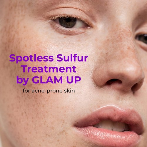 GLAM UP 10% Sulfur Treatment Spot Serum - Fast Healing for Pimples & Acne Breakouts | 15mL