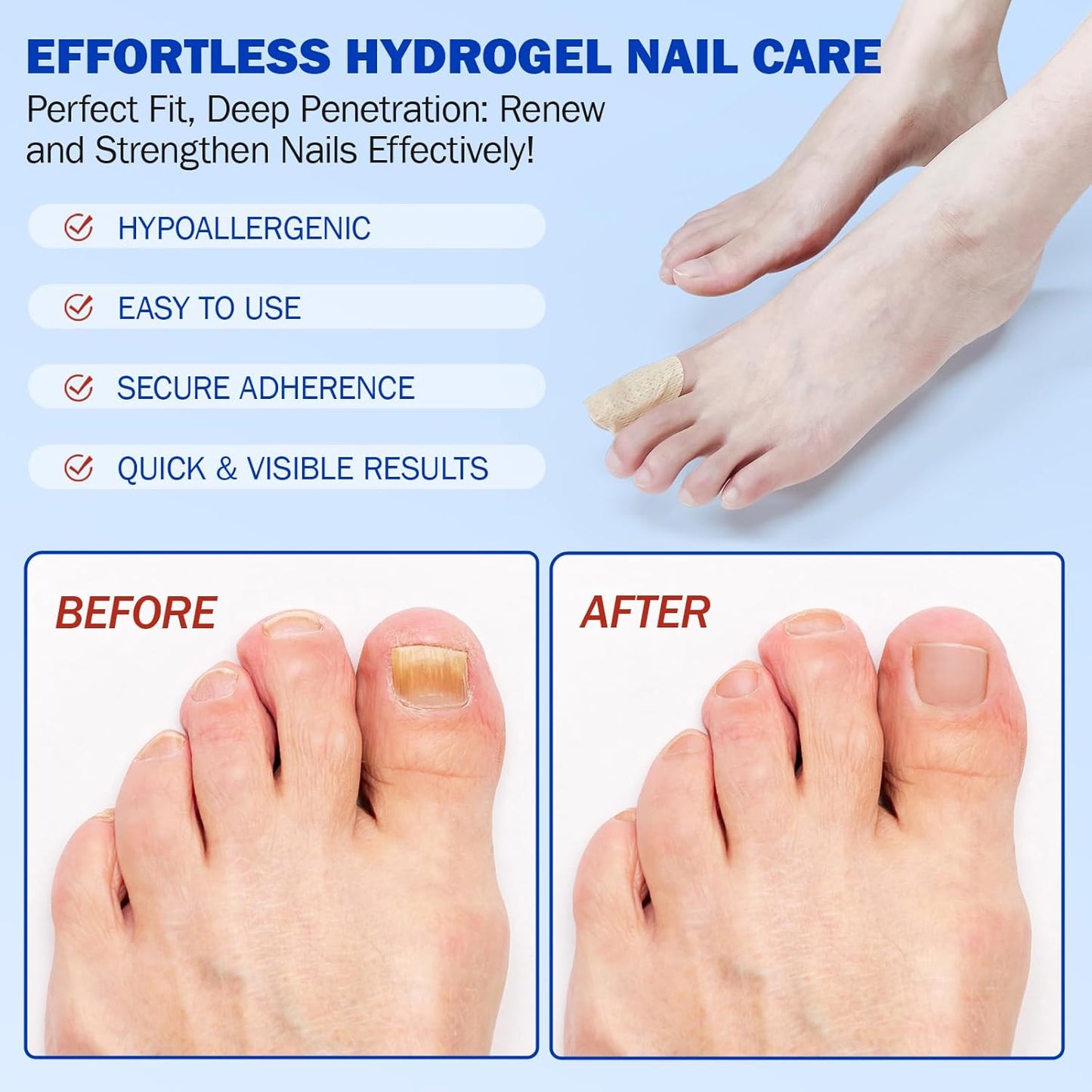 Skiennix Fungal Nail Patches - Extra Strength 8-Hour Overnight Treatment | 42 PCS Hydrogel Care for Damaged Nails