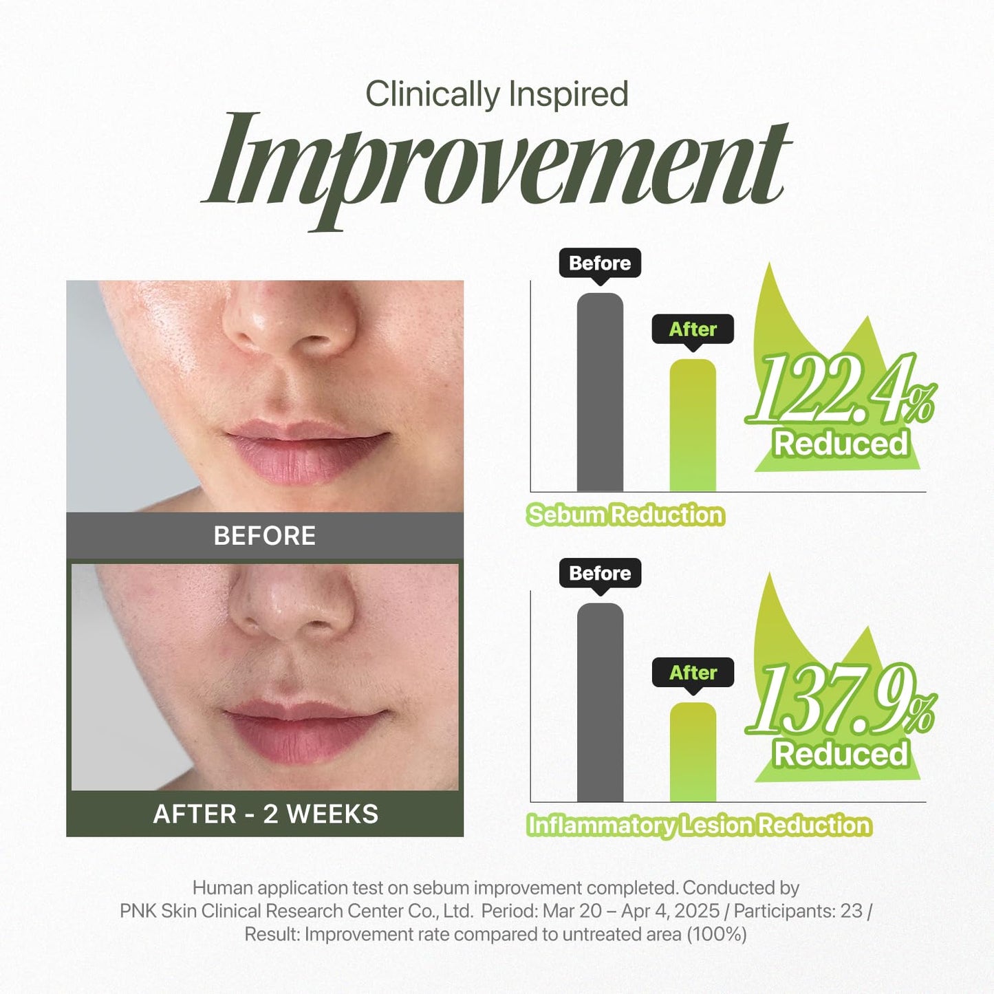 Trouble Patch Mask - Hydrocolloid Acne Face Mask for Pimple-Prone Skin | Oil Absorbing, Full Face Treatment (20ml x 4)