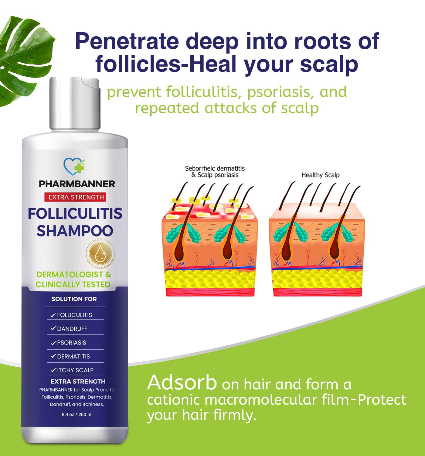 PHARMBANNER Anti-Fungal Shampoo for Folliculitis, Seborrheic Dermatitis, Scalp Psoriasis - Relieves Itchy & Dry Scalp