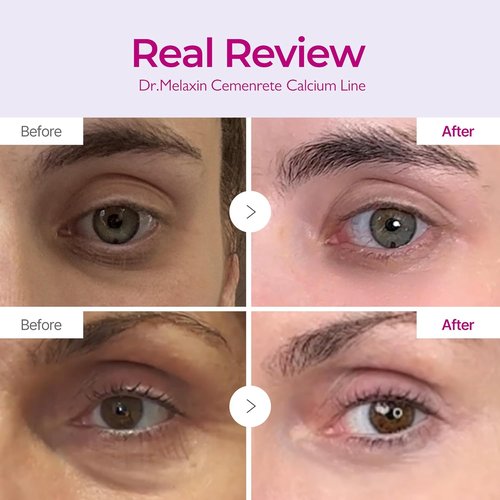 Dr. Melaxin Calcium Intense Firming Cream - Lifting & Volumizing Face Cream with Collagen & Elastin, 1.69 fl. oz.
