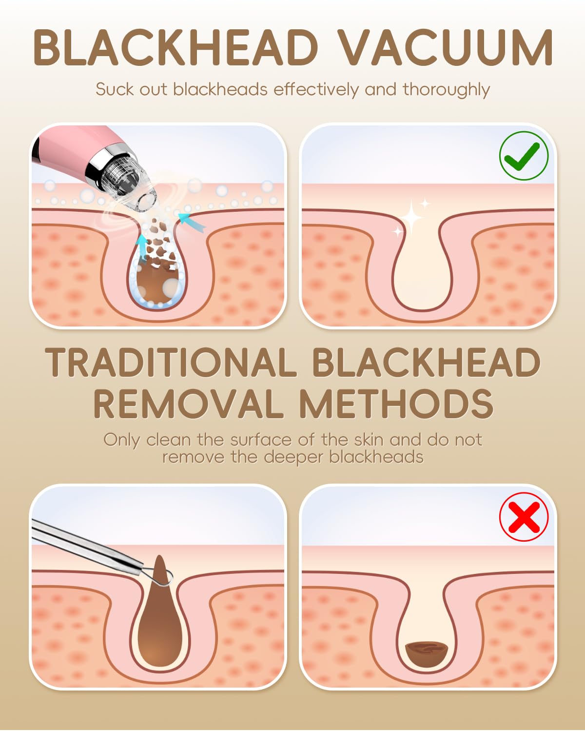 Facial Pore Blackhead Remover Vacuum - Face Cleaner and Blackhead Extractor with 3 Adjustable Suction Levels, 5 Probes, USB Charging Interface - Pore Vacuum Kit for Women&Men (Pink)