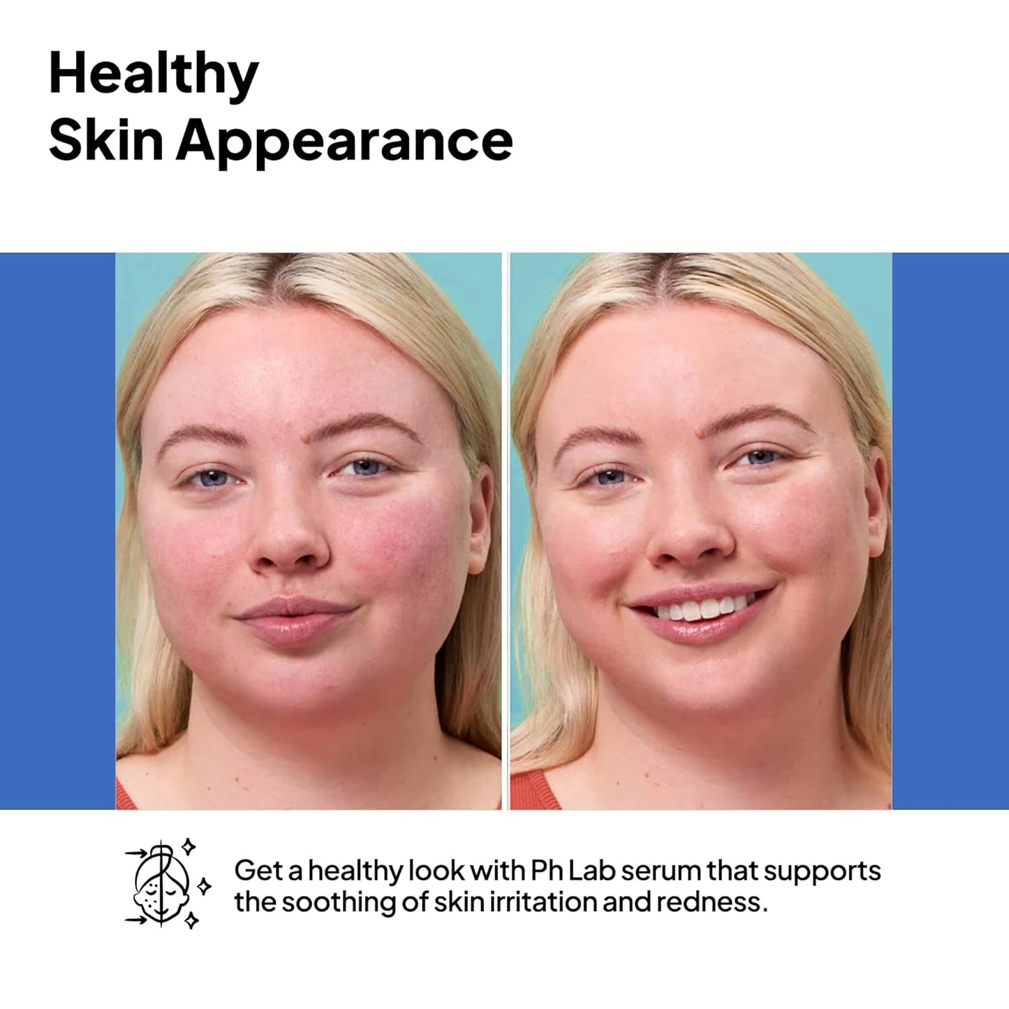 Skiennix Anti-Redness Serum - Reduces Capillary Cracks & Evens Skin Tone | 1.01 Fl Oz