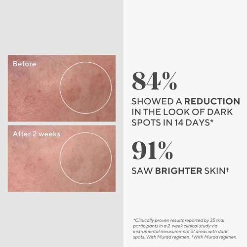 Murad Rapid Dark Spot Correcting Serum - Brightening Treatment for Hyperpigmentation - 0.33 Fl Oz