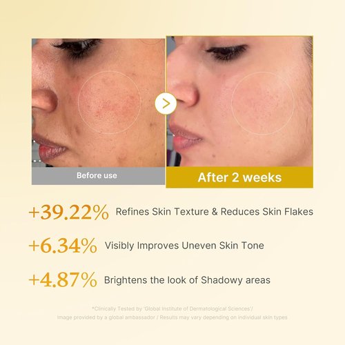 Medicube Kojic Acid Turmeric Toner - Lightweight Formula for Even Skin Tone & Texture | 8.45 fl. oz