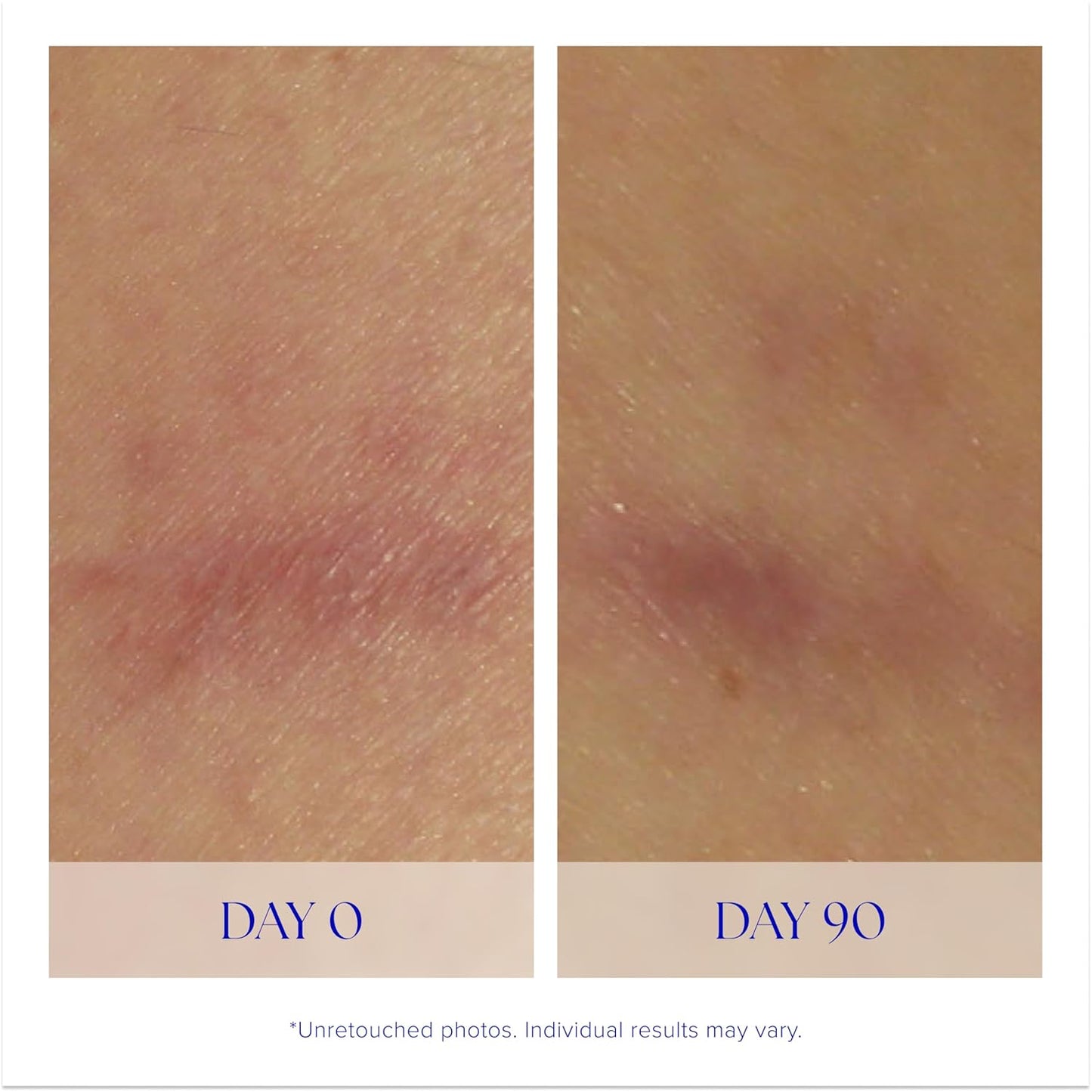 iS CLINICAL Super Serum Advance+ | Anti-Aging Vitamin C Face Serum for Scarring & Fine Lines