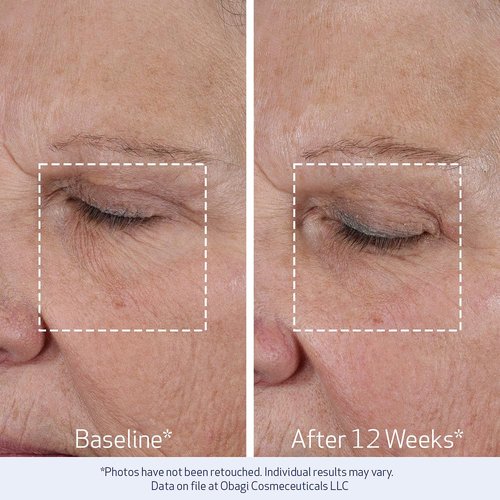 Obagi ELASTIderm Lift Up & Sculpt Facial Moisturizer - Clinically Proven Anti-Aging Cream for Firming & Smoothing - 1.7 oz