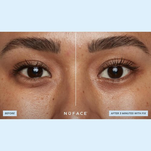 NuFACE IonPlex Hydra-Gel Under Eye Patches - Cooling Treatment for Puffy Eyes & Dark Circles (60 Count)