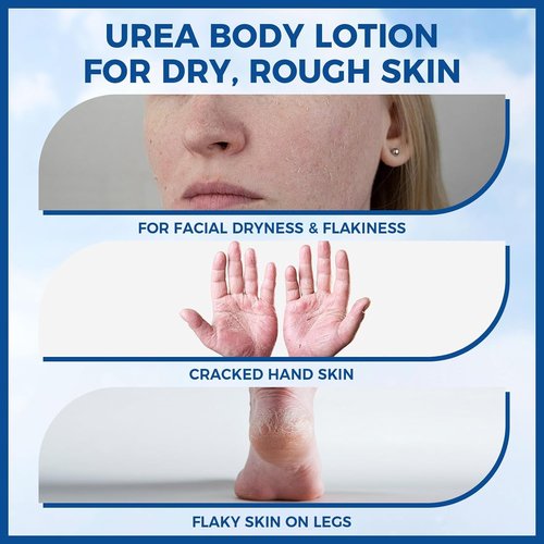 OUKEYA Urea Cream - Deep Moisturizer for Dry Skin | 10% Urea Formula, Fast Absorbing, 11.28 oz