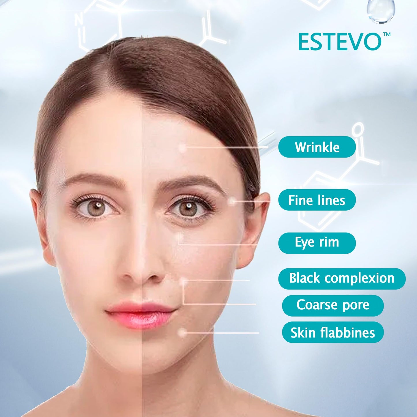 ESTEVO PDO Screw Thread, Improves Skin, Lift and Restore Skin Elasticity and Radiance, Pdo Thread Increase Firmness (20PCS-27G*60mm)