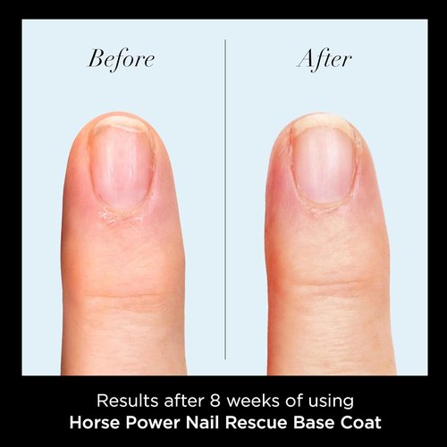 butter LONDON Nail Rescue Base Coat - Strengthens & Restores Damaged Nails | Gluten-Free, 0.2 Fl Oz