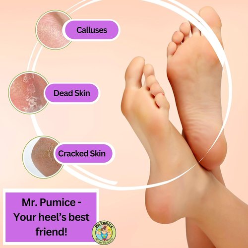 Mr. Pumice PUMI Bar - Extra-Coarse Pumice Stone for Callus Removal | 4-Pack Foot Care Tools