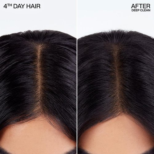 Redken Deep Clean Dry Shampoo - Refreshes All Hair Types, Absorbs Oil Without Buildup | Dark or Light Hair