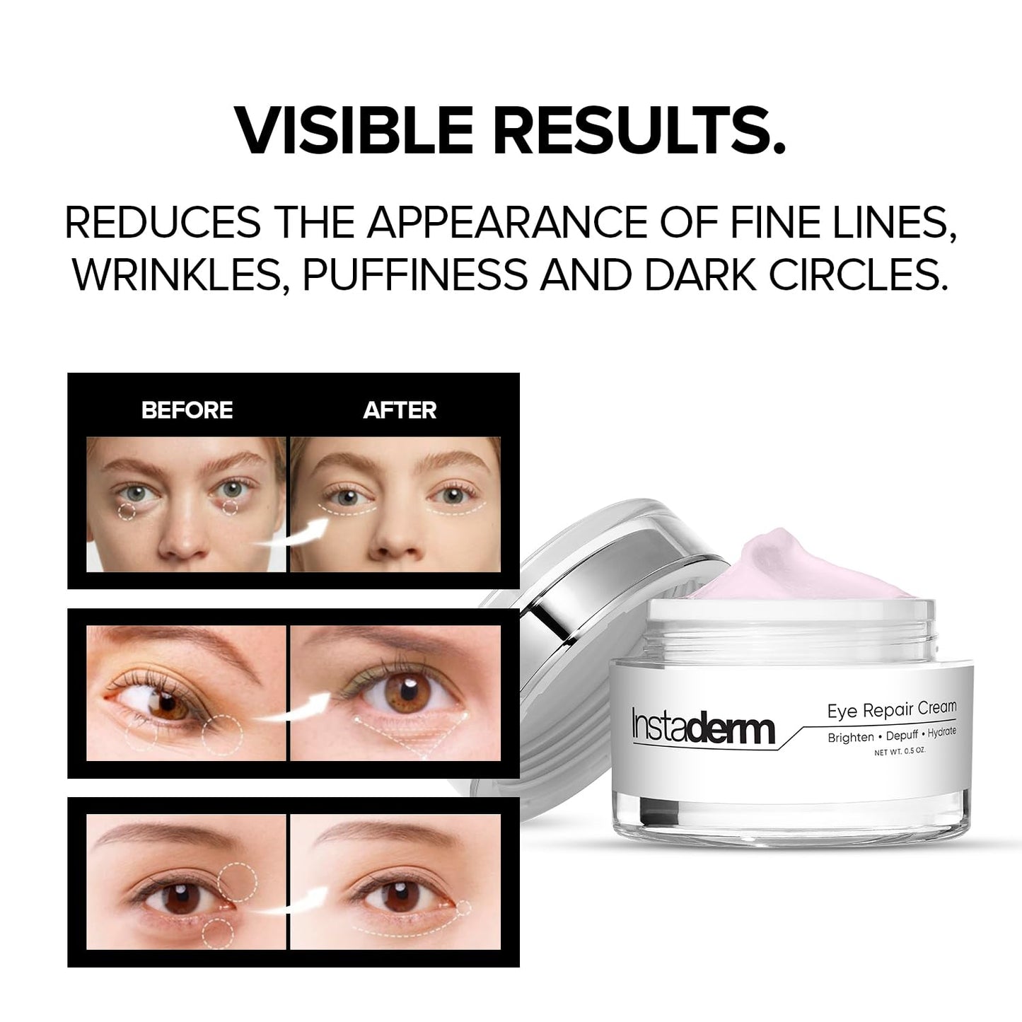 Skiennix Eye Repair Cream - Anti-Aging Formula with Niacinamide to Reduce Dark Circles & Puffiness | Hydrates & Brightens Skin