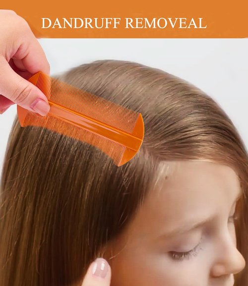 Dandruff Comb - Fine Tooth Scalp Detox Tool for Lice Removal | Stainless Steel Hair Brush (Black & Orange)