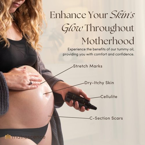 Matrescence Stretch Mark Relief Belly Oil - Hydrating Spa-Quality Maternity Treatment | 3.4oz Non-Greasy Formula for Moms