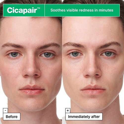Dr.Jart+ Cicapair Serum - Soothing Korean Face Mask for Redness Relief | Centella Asiatica | Sheet Mask