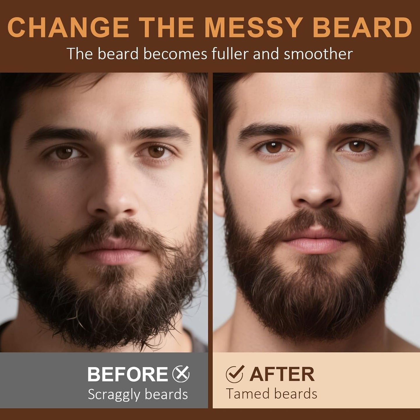 XIKEZAN Beard Oil Set - 5 Pack with Sandalwood, Orange, Vanilla & Cedarwood | Moisturizing Gift for Men