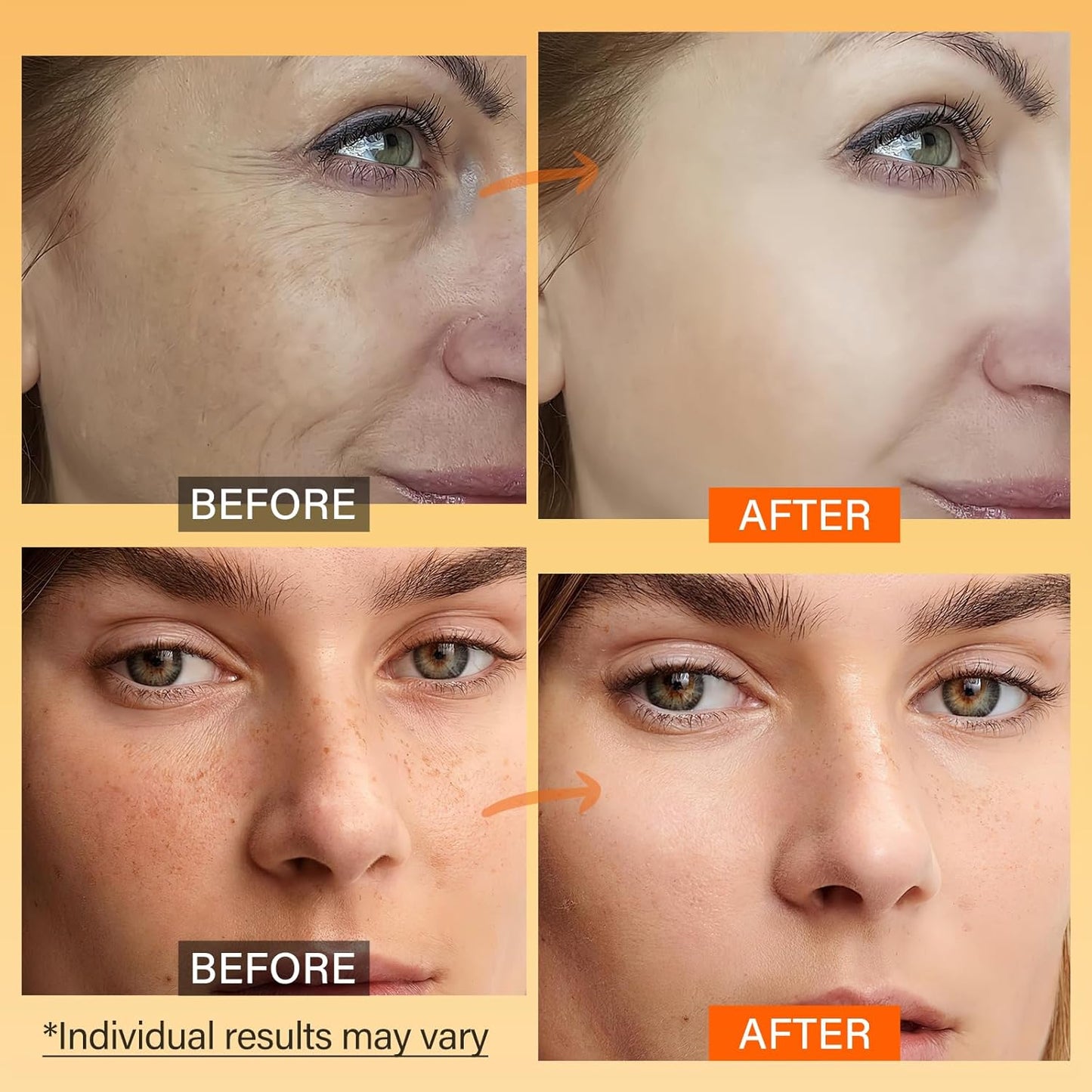 Skiennix Vitamin C Face Moisturizer - Brightening Anti-Aging Cream with Turmeric & Niacinamide, 2.3 Oz