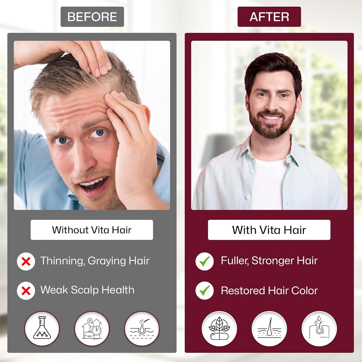 Vita Hair Growth Supplement - Micronized Formula for Healthier Hair | 100% Natural, 300 Capsules