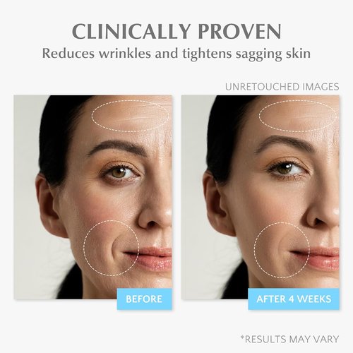 EnaSkin Retinol Collagen Face Cream - Anti-Aging Moisturizer with 7% Hyaluronic Acid | 1.7 Oz for Day/Night Use