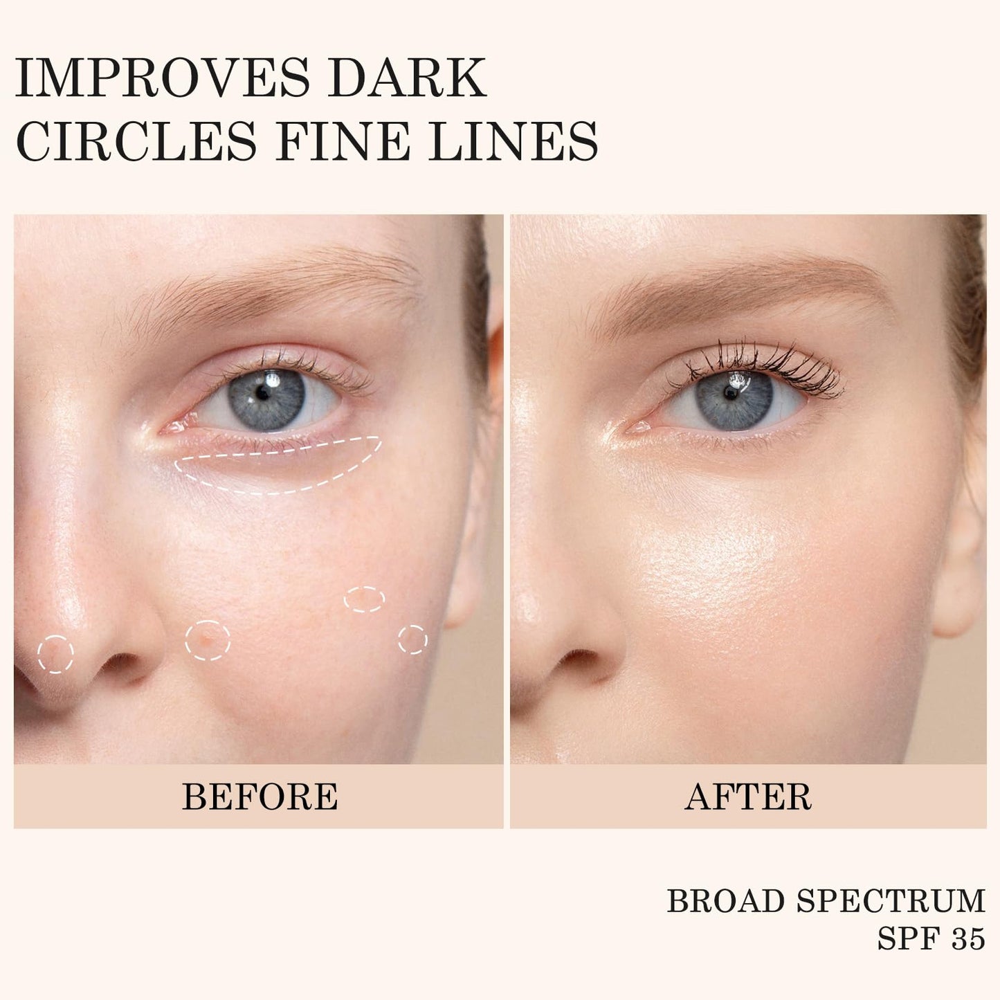 KYDA Mineral Sunscreen Eye Cream, 3-in-1 Anti-Aging Eye Cream, SPF 35, for Dark Circle and Fine Lines, Light