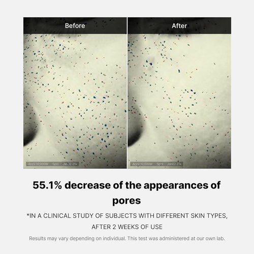 Medicube Zero Pore One-Day Cream - Pore Refining Formula with Salicylic Acid & Niacinamide | 1.69 fl. oz.