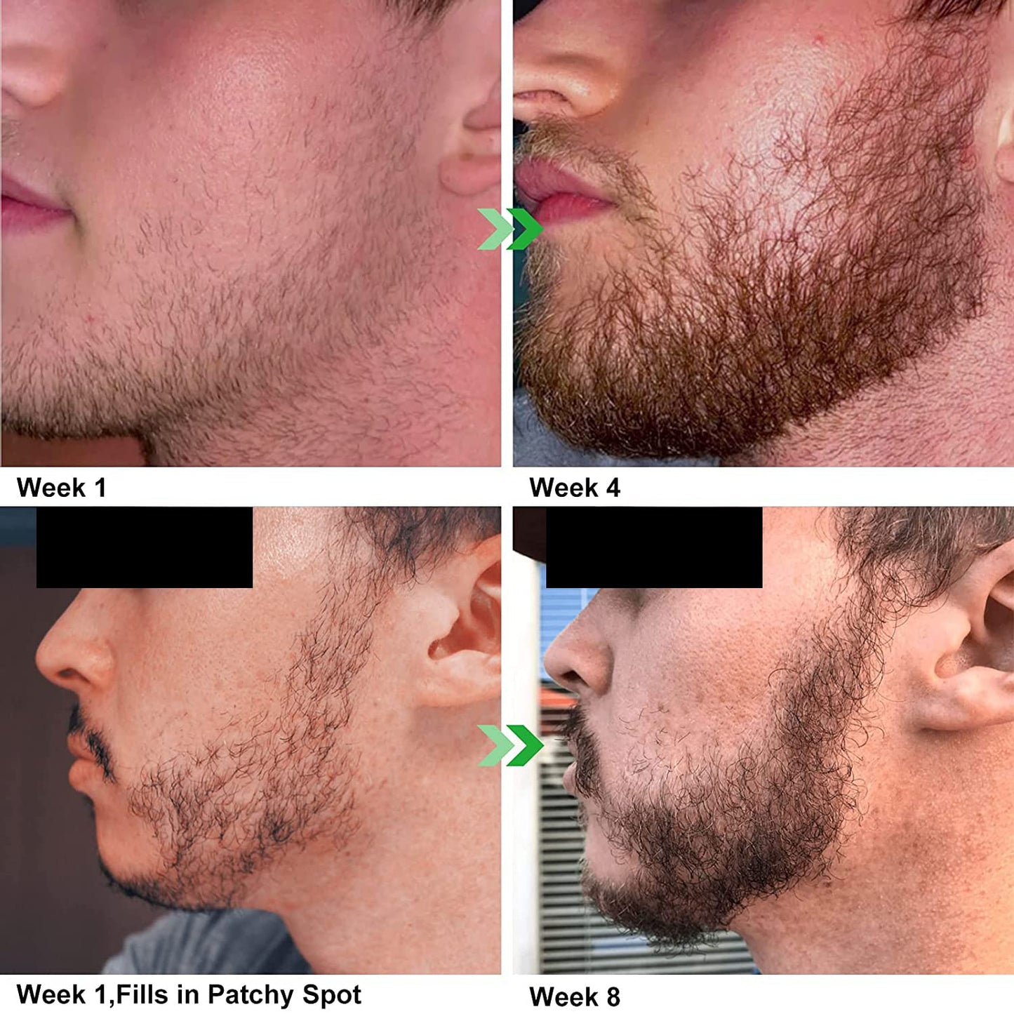 Unscented Beard Oil by [Brand Name] - Natural Hydrating & Conditioning Blend - 32 oz for Growth & Smoothness