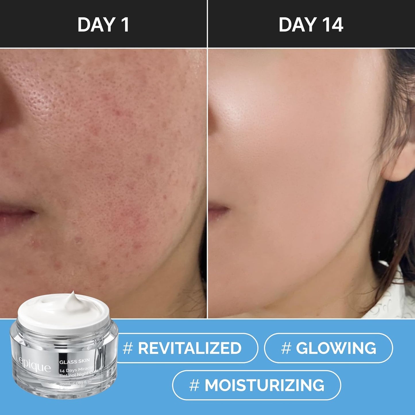 Skiennix Retinol Night Cream 1.69oz - Premium Korean Overnight Repair for Face & Neck - Hydrating, Anti-Aging Formula