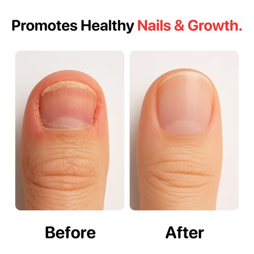 C CARE Nail Biting Prevention for Kids & Adults | Safe, Bitter, Clear, Thumb Sucking Deterrent | Stop Nail Biting Treatment for kids & Adults, Fast Drying, Easy Brush On, 0.5 fl oz