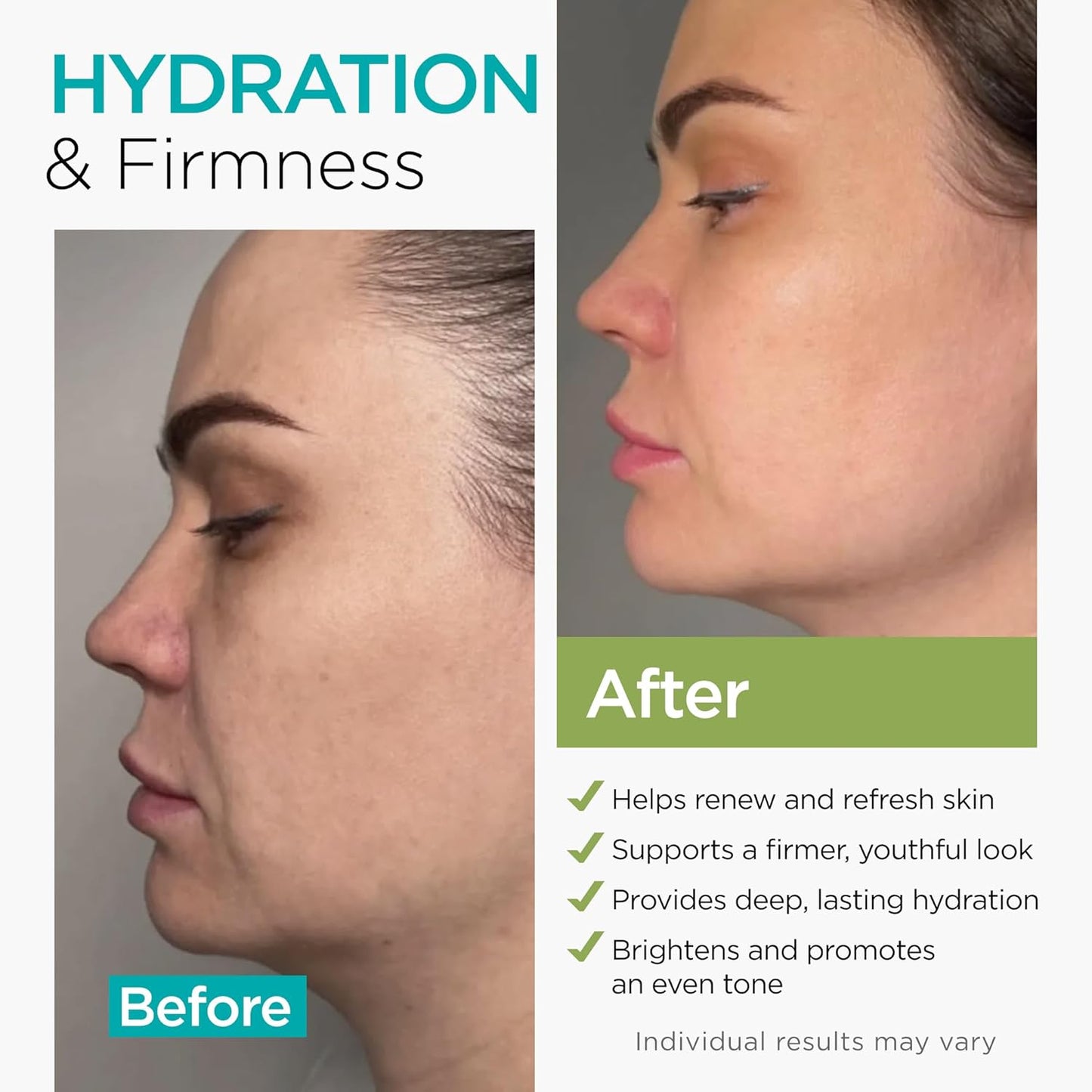 Skiennix Collagen NAD+ Face Cream - Anti-Aging Retinol & Hyaluronic Acid Moisturizer - 1.7 Oz