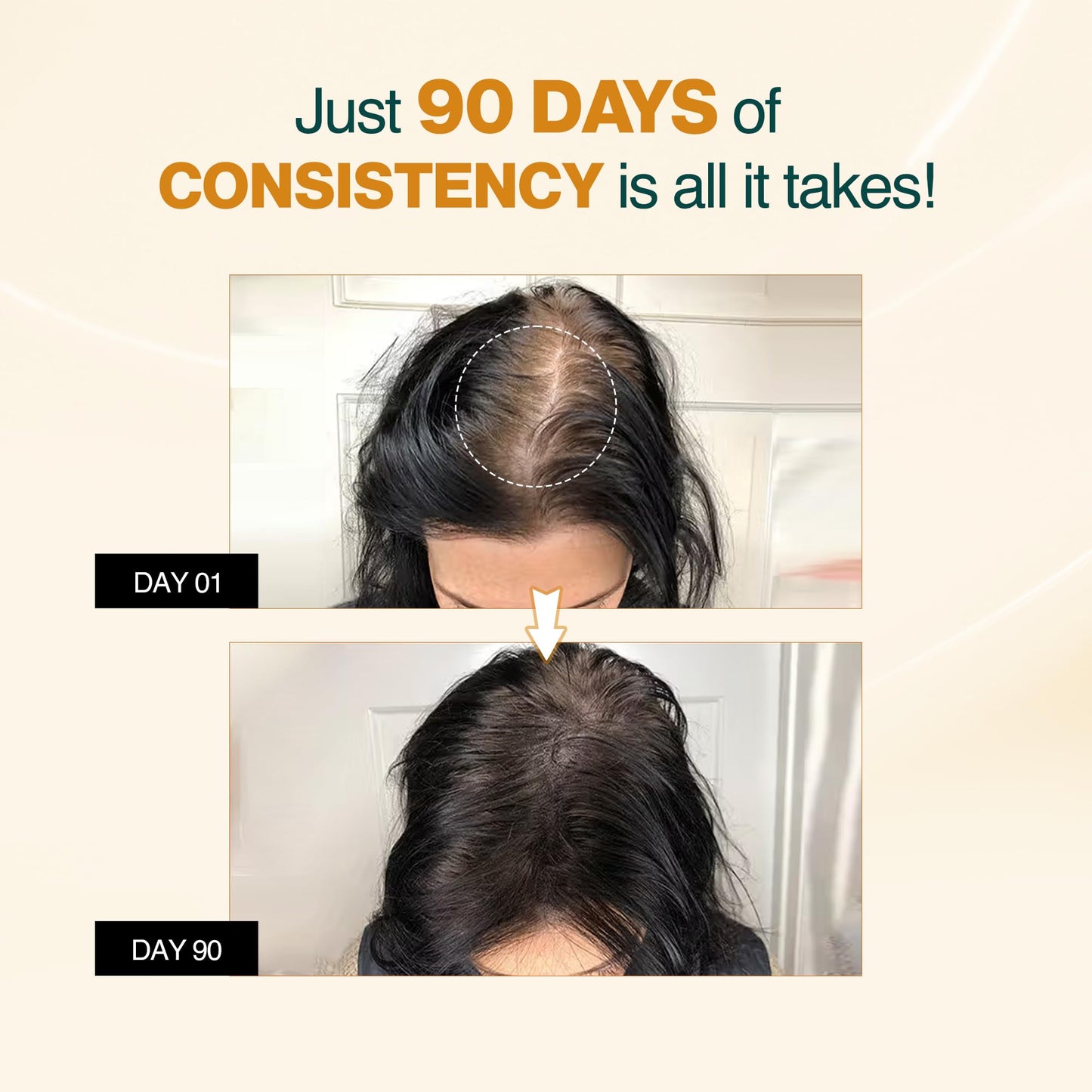 Nourish Mantra - Advanced Hair Growth Serum For Women & Men | Made With Redensyl, Anagain, Procapil & Rice Water | Prevents Hair Fall & Thinning | Promotes Hair Regrowth 25 ml