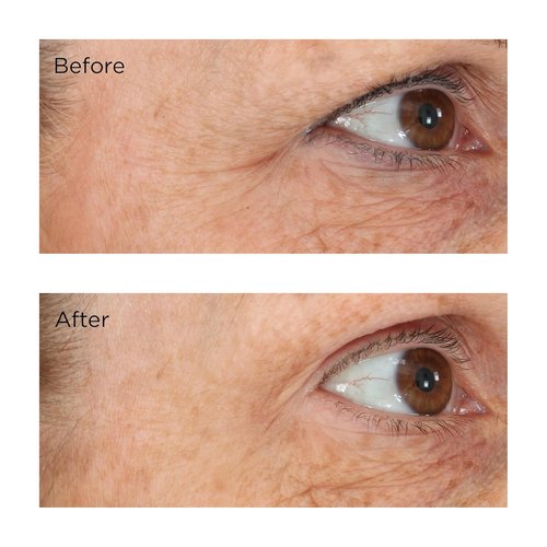 Perricone MD Eyelid Lift Serum - Essential Fx Acyl-Glutathione, 0.5 Ounce for Youthful Eyes