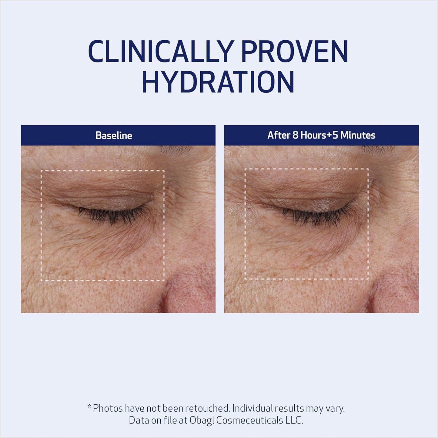 SUZANOBAGIMD Moisture Restore - Medical-Grade Multi-Layered Hydration for Redness Relief & Improved Skin Texture - 1.7 oz