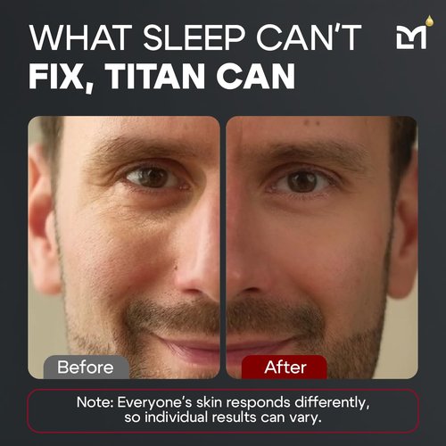 Man Labs Titan Peptide Cooling Eye Serum - Anti-Aging Eye Cream for Men | Reduces Dark Circles & Puffiness