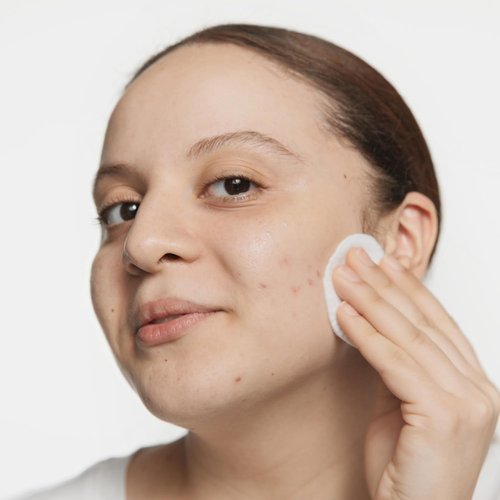 Clinique Acne Solutions Clarifying Lotion - Exfoliating Facial Toner with Salicylic Acid | Reduces Oil & Unclogs Pores