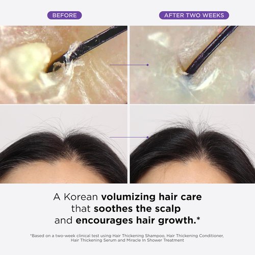 Dr. Groot Thickening Serum Set | Biotin & Rosemary for Hair Loss, Thinning & Scalp Repair
