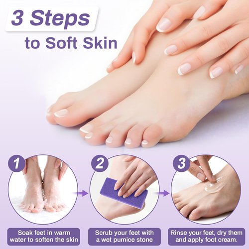 RAQEHO 10 Pumice Stone for Feet - 4.7 x 2 x 1 Inch Double Side Purple Foot Pumice Stone, Foot Filer Pedicura Scrubber for Callus Removal, Foot Care Spa Productos for Dark Elbows Hard Skin Exfoliating