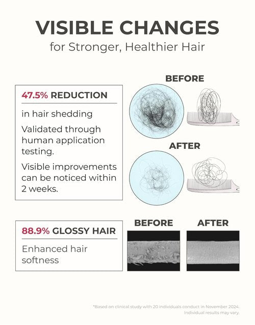 Motifull Hair Growth Treatment - Boost Thinning Hair with Biotin & Caffeine | 6.76 fl oz