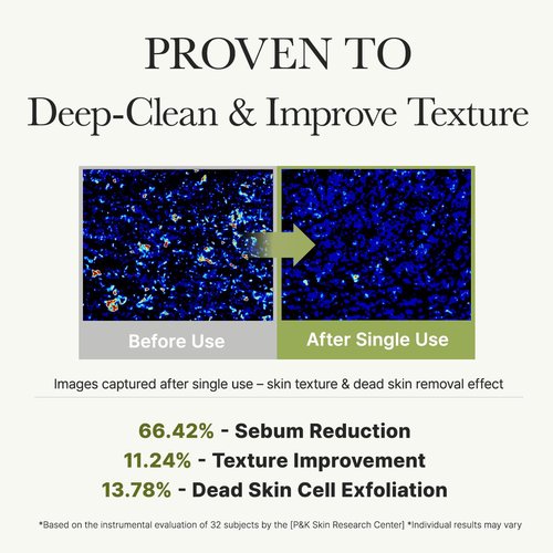 ARENCIA Salicylic Acid Cleanser - Deep Pore Cleansing with Green Tea & LHA | 5.07 Fl Oz