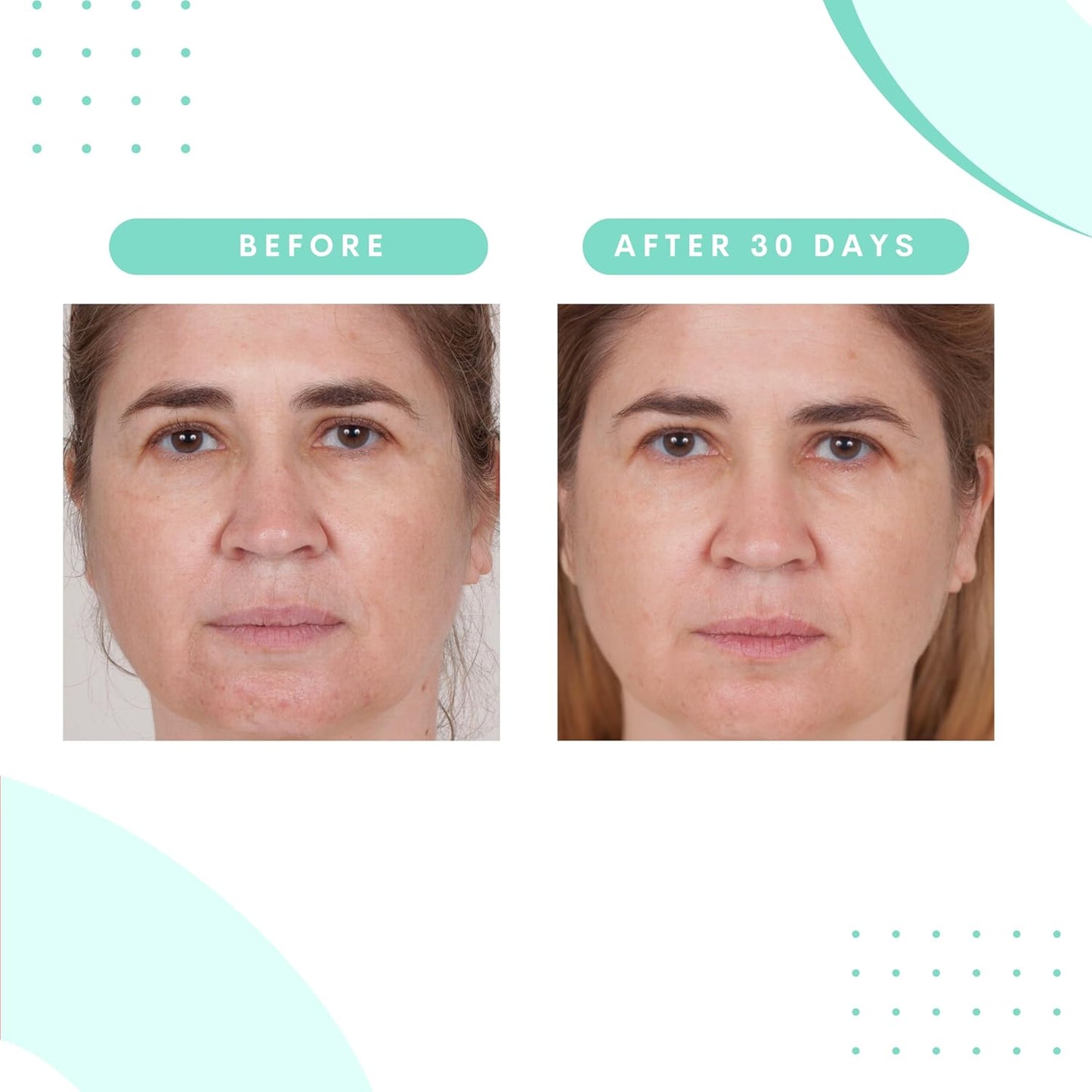 Serious Skincare Glycolic Acid Treatment Pads - Exfoliating Face Discs for Fine Lines & Wrinkles | 2 Pack (60 Pads Each)